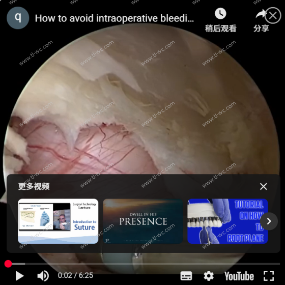 UBE手术中如何避免术中出血